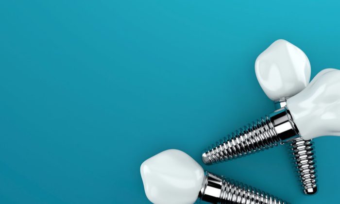 types of dental implants Annapolis Maryland